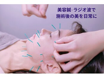 ヴェリタス(VERITAS)