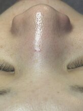 美ハグ 横浜青葉台(美hug)