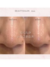 ムゥ(muu)/毛穴洗浄