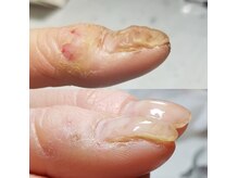 and meの雰囲気(爪の育成、爪のお悩み、お任せください)
