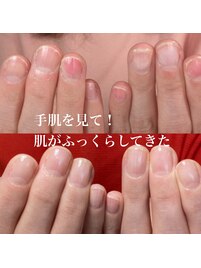 自爪育成/深爪育成/ネイルケア