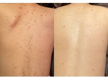 ジュエリーボディー(Jewelry body)/まだ間に合います！！