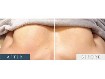 ウンスイスパ(UNSUI SPA)/バストアップケア