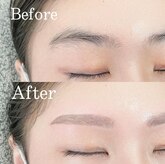 ルアンエステティック(RUAN esthetic)