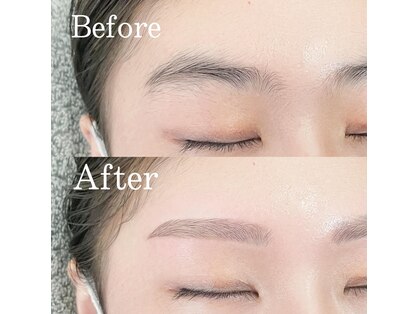 ルアンエステティック(RUAN esthetic)の写真