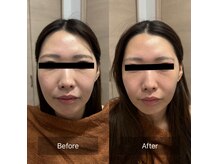 たかやなぎ整体院の雰囲気（小顔矯正メニュー）