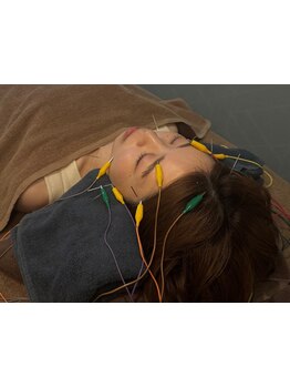 鍼灸施術を受けたい