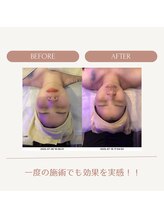 効くラボ 新宿店/小顔×リフトアップ×ツヤ！