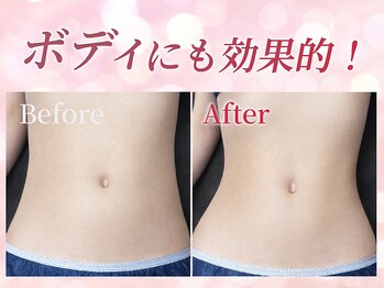 小顔専門店Lift(痩身・リフト)栄/小顔専門店Lift|小顔施術