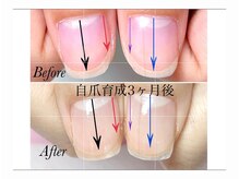 トゥインクリーネイルサロン(Twinkly Nail Salon)/【地爪育成】1回お試し