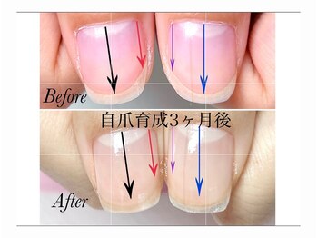 トゥインクリーネイルサロン(Twinkly Nail Salon)/【地爪育成】1回お試し
