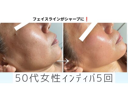 アモル(Amor)の写真