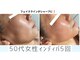 アモル(Amor)の写真