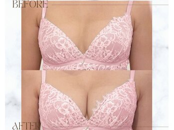 リアン 栄店(Lien)の写真/他店で満足できなかった方へ◆産後授乳後の削げ・垂れを整えハリ不足をケアする育乳!根本改善でバストケア