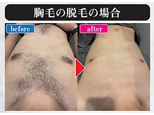 マンモス 赤羽店の雰囲気（脱毛のプロである私たちにお任せください！）