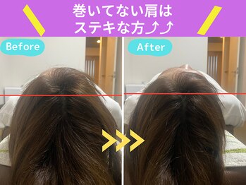 京都中丸整体カイロプラクティック/まき肩