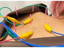 駒込ていくけあ鍼灸整骨院/首肩こりもお任せください！