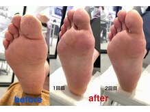 シー(She)/フットケア