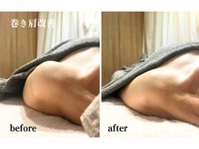 オトサロン(Otosalon)/開け、肩！整体マッサージ