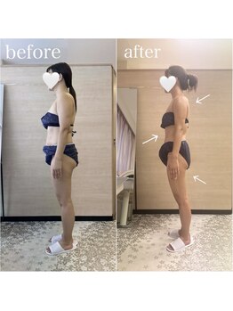 エステティックサロン アール 大阪梅田(esthetic salon R)/30代女性　横