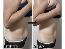 カピリナ(Kapilina)/ WINBACK90 1回【60代前半女性】