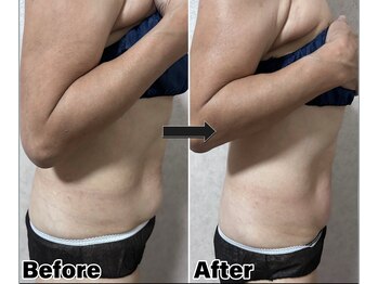 カピリナ(Kapilina)/ WINBACK90 1回【60代前半女性】