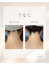 ルウム 大垣店(lum)/【脱毛サロン】うなじ脱毛