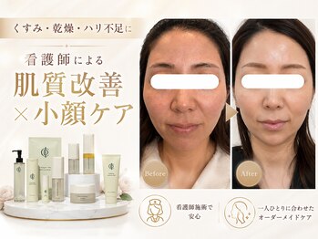 エン 橿原店(en)の写真/肌質改善も小顔も叶えたい方へ。看護師によるオーダーメイド美肌ケア。