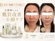 エン 橿原店(en)の写真/肌質改善も小顔も叶えたい方へ。看護師によるオーダーメイド美肌ケア。