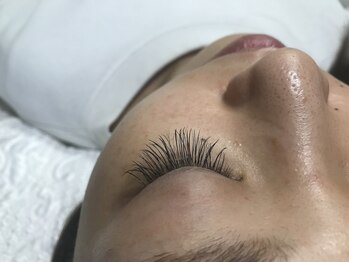 アネラカプア(Anela Kapua)/