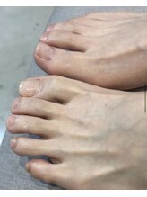 ハイルング(HEILUNG)/foot care