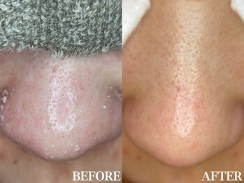 サロン ムスブ(salon MUSUBU)/山梨エステ/甲府エステ