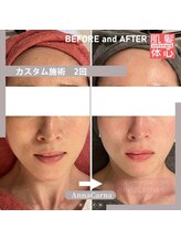 アンナカルナ(AnnaCarna)/強引な小顔矯正は危険です