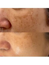 シュシュエステプリューム(Chou Chou Esthe PLUME)/