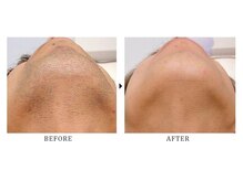 サロン ド スカイ(Salon de sky)/男性・ヒゲ