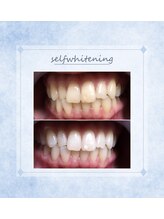 ソレラ(sorelle)/ホワイトニング