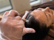 髪顔体/ダーマスタンプ