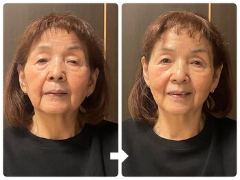 サロン ド ジョワ(salon de joie)/70代驚きの効果