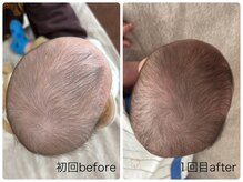 ラフィング(Laughing)/頭の形　赤ちゃん整体