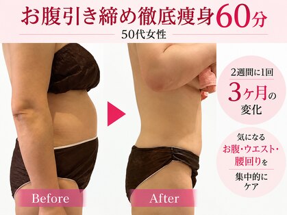 ビューティスト(Beautist)の写真