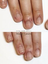 マリーロール 梅田店(Marie Laure)/自爪育成/深爪矯正/ネイルケア