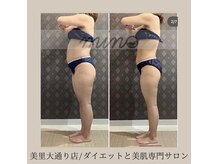 ミノ 美里大通り店(mino)/ダイエットパッケージ