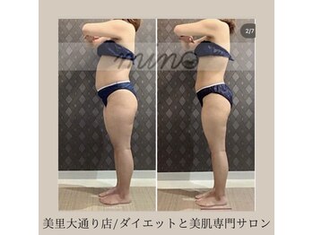 ミノ 美里大通り店(mino)/ダイエットパッケージ