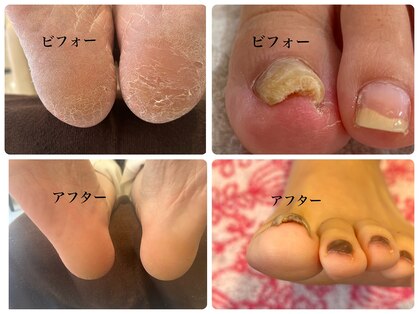 ネロリ(Neroli)の写真