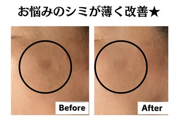 グレースティー 森町 箕面/シミが薄く毎日のメイクが楽しい