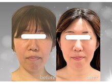 ソナ 大和西大寺院(SONA)/