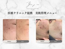 ユウキュウ(you q.-)/キュライムは美肌管理も。