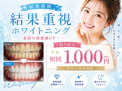 エクシアホワイトニング 岡崎店の写真