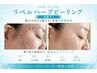 【初回体験】リベルハーブピーリング60分(剥離あり)￥55,000→￥22,000