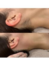 ニクス 札幌(NIX)/うなじワックス